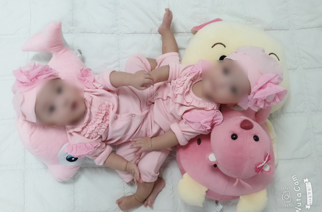 Thực hiện mổ tách cặp song sinh dính phức tạp - ảnh 1