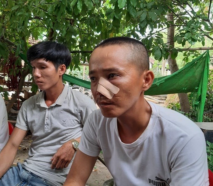 truy-sat-anh-cap