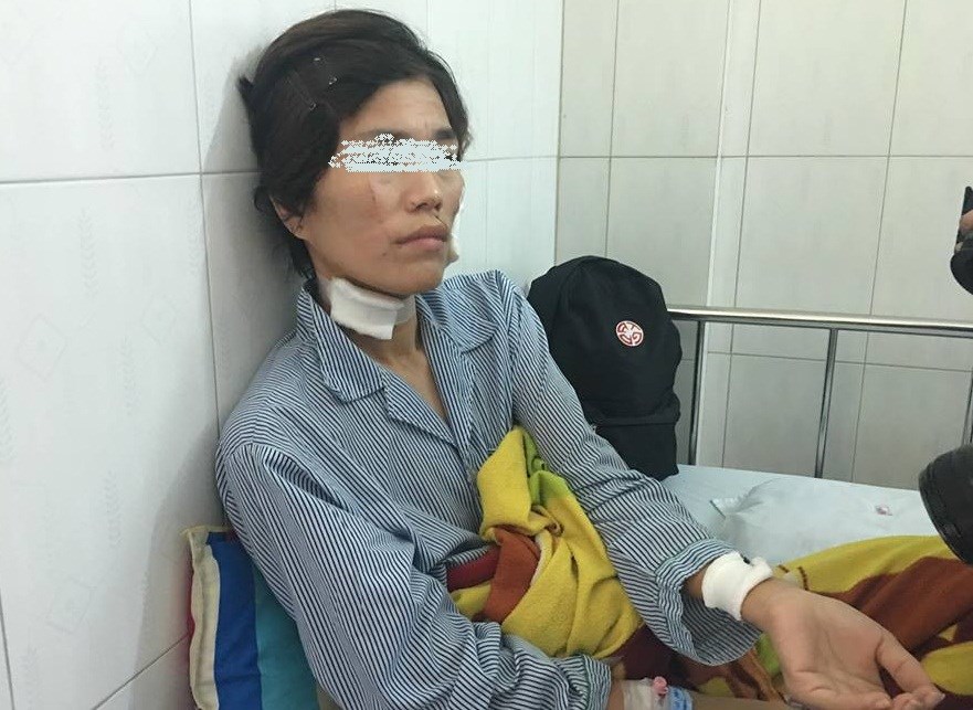 bạo hành 4