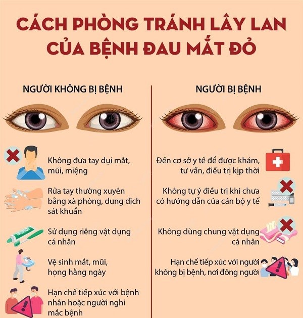 Nghệ An: Số trẻ đau mắt đỏ tăng đột biến - ảnh 1