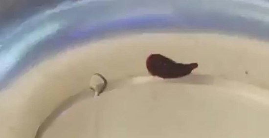 Nghệ An: Phát hiện con vắt dài 5cm sống ký sinh trong mũi của người phụ nữ - ảnh 1