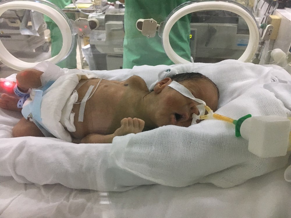 Kỳ vọng về một ngày người mẹ ung thư lần đầu được gặp con - ảnh 2