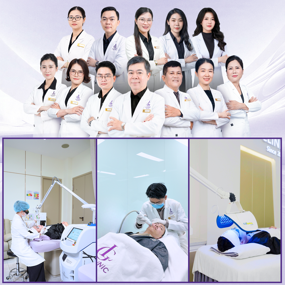 Triple Treatment – Điều trị sẹo rỗ công nghệ hàng đầu Âu Mỹ tại LG Clinic - ảnh 4