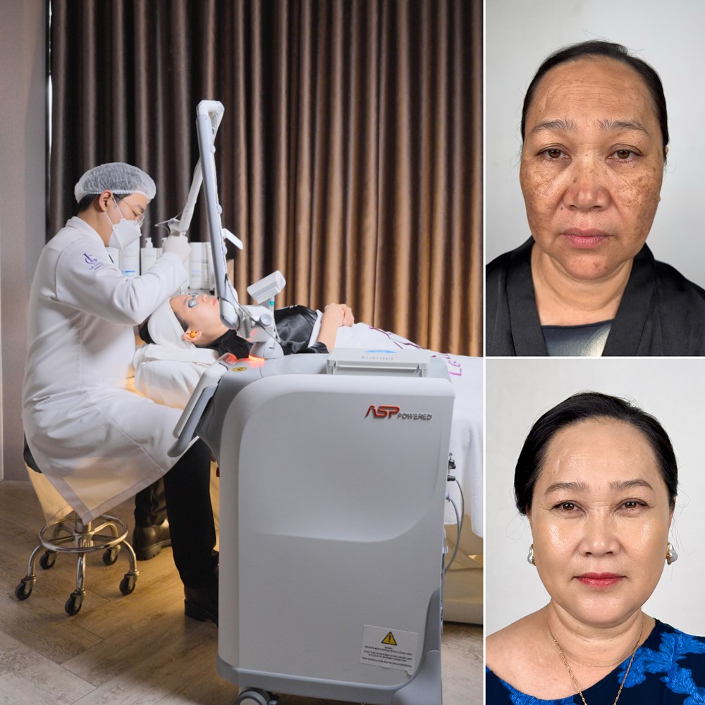LG Clinic “bắt tay” với Fotona, sở hữu công nghệ Hybrid Pico Laser đỉnh cao từ Hoa Kỳ - ảnh 2