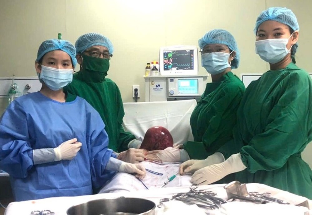 Bệnh viện Quân y 121 phẫu thuật thành công khối u xơ tử cung khoảng 4,5kg - ảnh 1