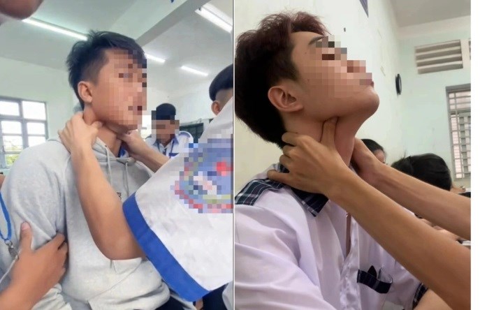 “Bắt pen” ở giới trẻ, trò chơi vô cùng nguy hiểm, có thể tử vong - ảnh 1