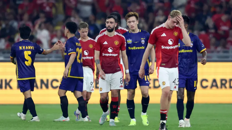 Manchester United cần cải thiện cả về chiến thuật lẫn phong độ của cầu thủ