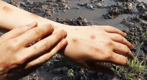 Bộ Y tế cảnh báo về bệnh “sốt đất” khiến 732 ca nhiễm, 23 trường hợp tử vong tại Thái Lan - ảnh 1