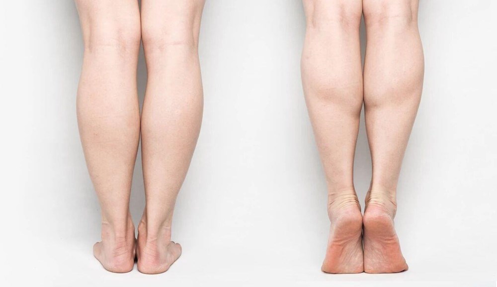 Kiễng chân giúp phòng ngừa huyết khối: Danh y xác nhận là thật, thêm 2 động tác khác cũng hiệu quả - ảnh 5