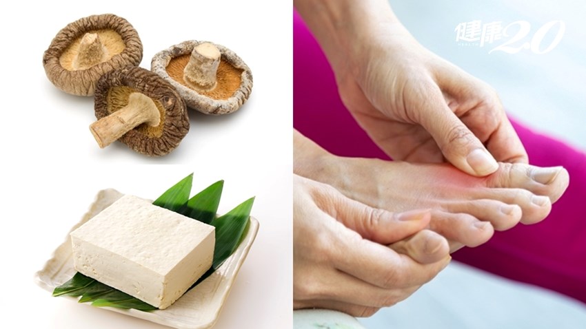 Chế độ ăn cho người bị bệnh gout: Khuyên dùng 4 “cao thủ” hạ axit uric, đậu phụ là một trong số đó - ảnh 2