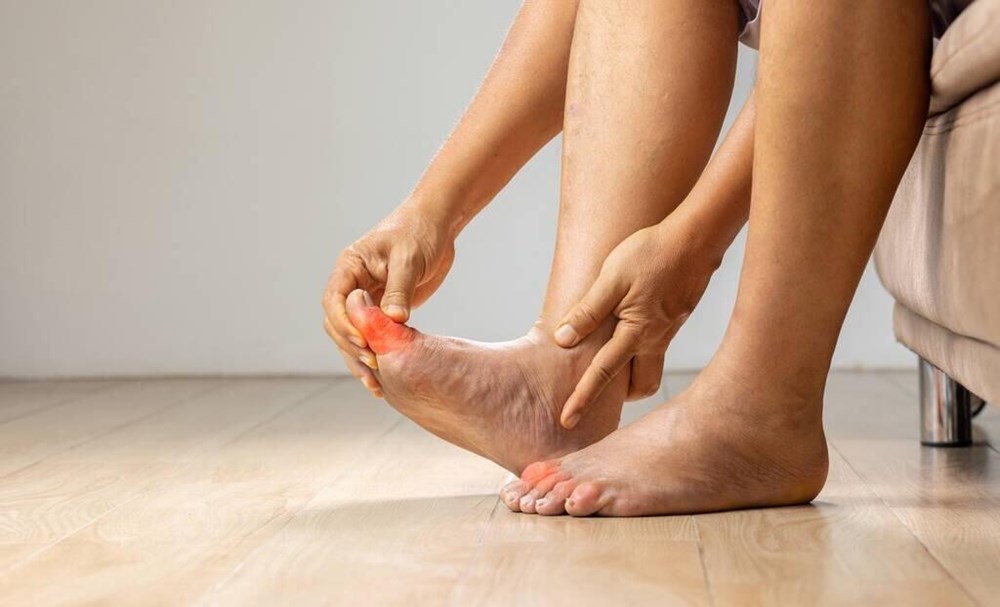 Chế độ ăn cho người bị bệnh gout: Khuyên dùng 4 “cao thủ” hạ axit uric, đậu phụ là một trong số đó - ảnh 4