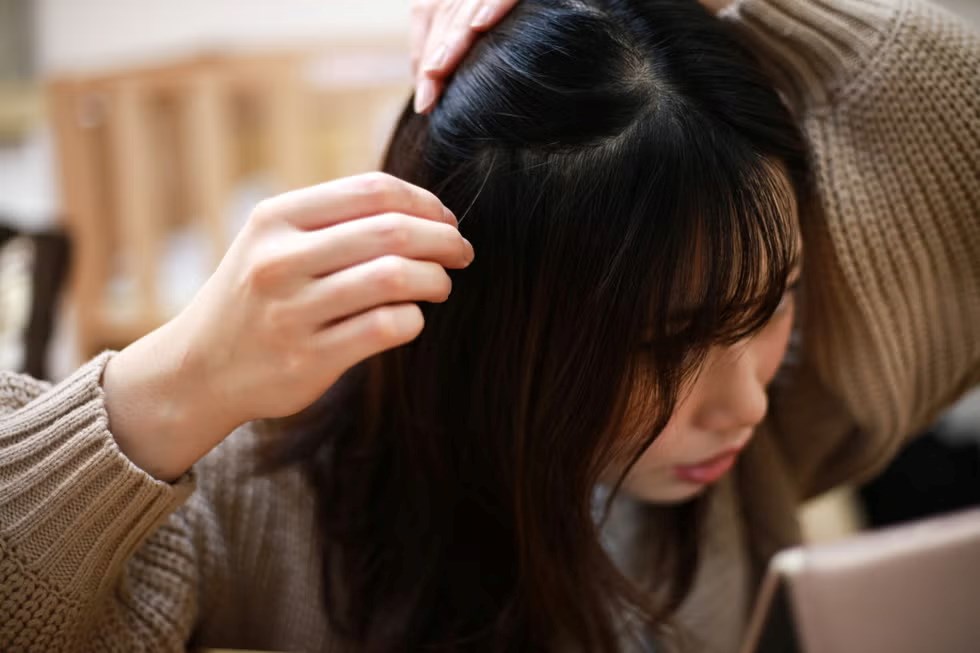 Tóc bạc sớm là do thiếu dưỡng chất, bổ sung 7 thực phẩm vàng sẽ giúp tóc “hồi sinh” - ảnh 3