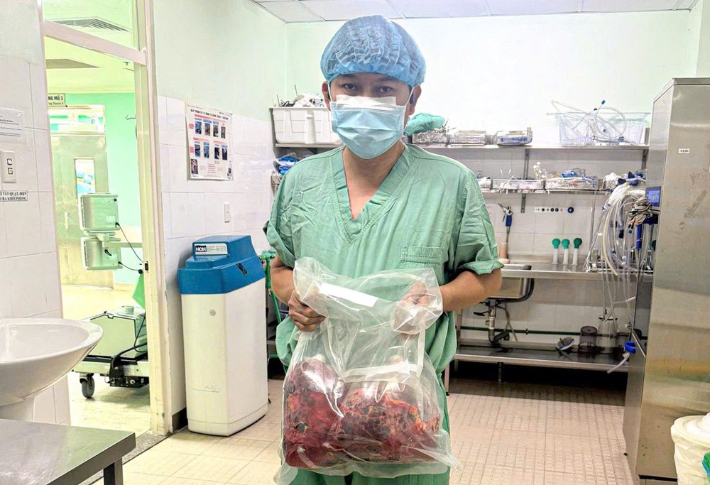 Cắt bỏ 2 thận đa nang gần 10kg và ghép thận thành công cho một bệnh nhân - ảnh 2