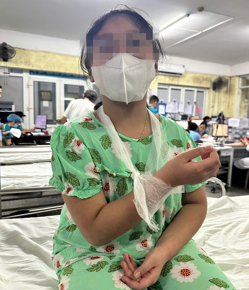 Xác minh vụ việc cô giáo đánh tay học sinh lớp 4 gây chấn thương - ảnh 1