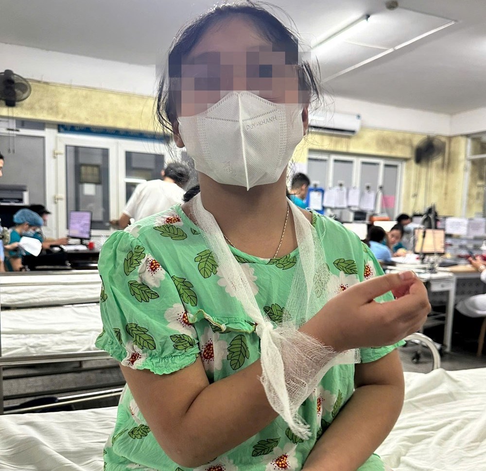 Bệnh viện chứng nhận thương tích của học sinh lớp 4 bị cô giáo đánh vào tay - ảnh 1