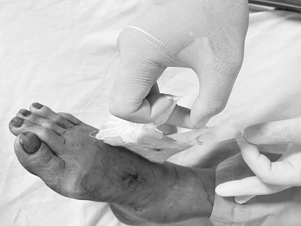 Chuyên gia nuôi rắn hổ mang bị chính “đối tác” cắn nhập viện, phải dùng 30 lọ huyết thanh - ảnh 1