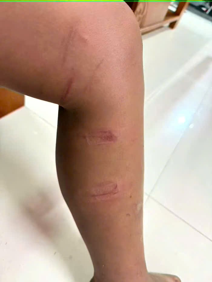 Lan truyền video ghi cảnh người đàn ông dùng cây đánh 3 bé trai trên đường - ảnh 3