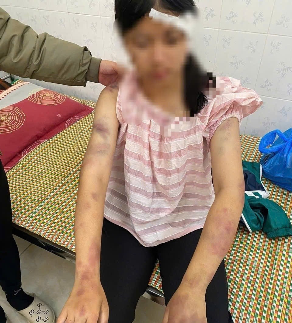 Hé lộ tình tiết sốc vụ bé gái nghi bị người nhà bạo hành dã man ở Thái nguyên - ảnh 1