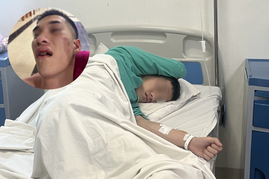 Xác minh vụ hành hung tập thể khiến nam thanh niên nhập viện ở Thái Nguyên - ảnh 1