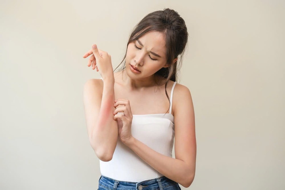Dị ứng thời tiết: Khi cơ thể “lên tiếng” trước những đổi thay của khí hậu - ảnh 2