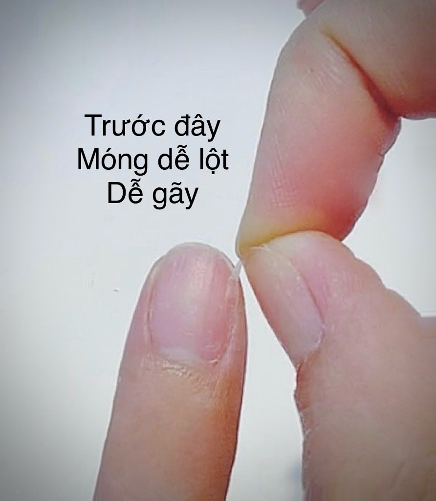 Thuỷ Tiên ăn chay trường, bất ngờ nhận điều thay đổi sau 1 năm  - ảnh 1