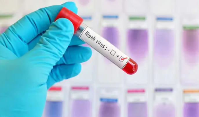 Không có vaccine, tỉ lệ tử vong tới 75%, có thể không triệu chứng: Bác sĩ giải thích vì sao dịch virus Nipah cần phòng tránh ngay từ đầu? - ảnh 3