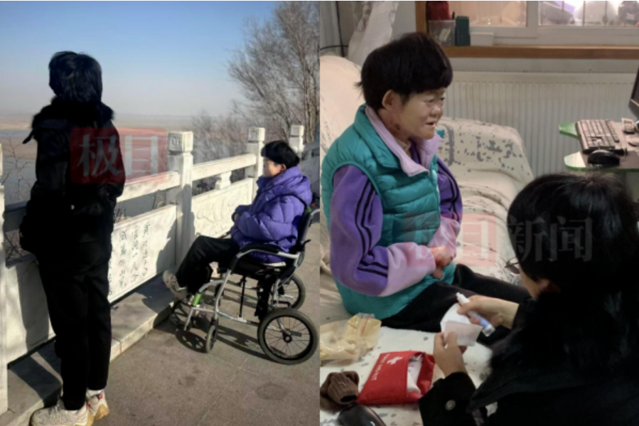 Từng bị chẩn đoán không sống quá 2 tuổi, “cô gái bươm bướm” hiện tại ra sao ở tuổi 25? - ảnh 3