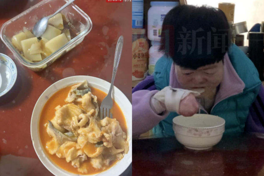 Từng bị chẩn đoán không sống quá 2 tuổi, “cô gái bươm bướm” hiện tại ra sao ở tuổi 25? - ảnh 2