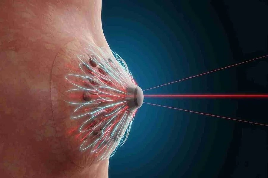 Á hậu Hong Kong mắc ung thư vú giai đoạn cuối dù phát hiện sớm: Dấu hiệu cảnh báo và cách tự kiểm tra - ảnh 2