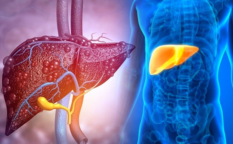 Nghiên cứu của Hàn Quốc trên 2,5 triệu người cho thấy: Trước 40 tuổi gặp vấn đề này sẽ tăng đáng kể nguy cơ ung thư - ảnh 2