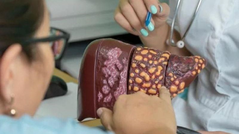 Nghiên cứu của Hàn Quốc trên 2,5 triệu người cho thấy: Trước 40 tuổi gặp vấn đề này sẽ tăng đáng kể nguy cơ ung thư - ảnh 3