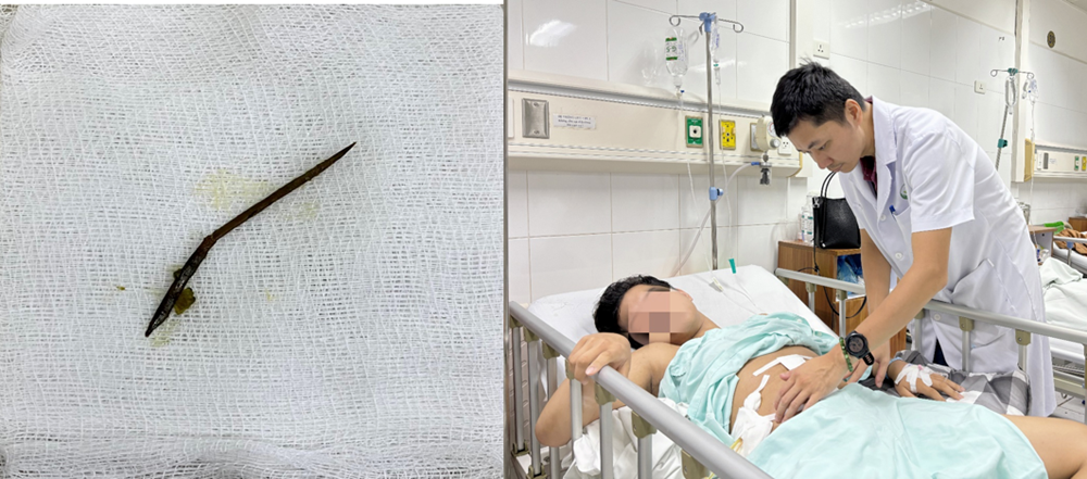 Nhiễm trùng ruột vì nuốt phải tăm - ảnh 1
