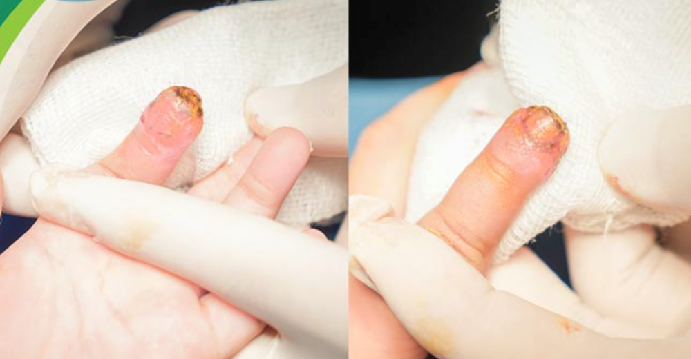 Xây dựng môi trường sống an toàn cho trẻ để phòng tránh tai nạn thương tích - ảnh 1