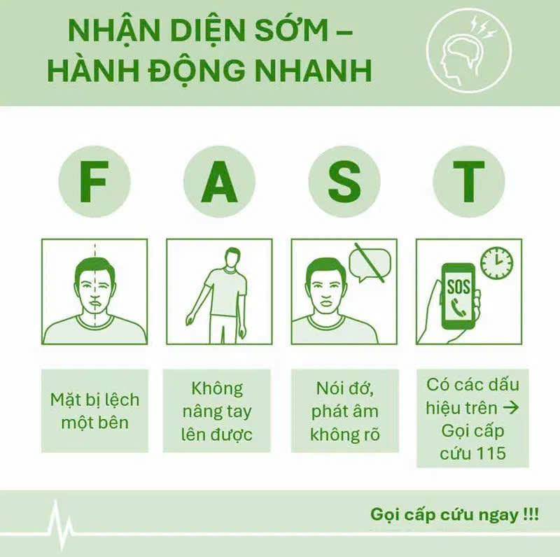 4 việc cần làm và 5 việc cần tránh khi sơ cứu người đột quỵ tại nhà - ảnh 1