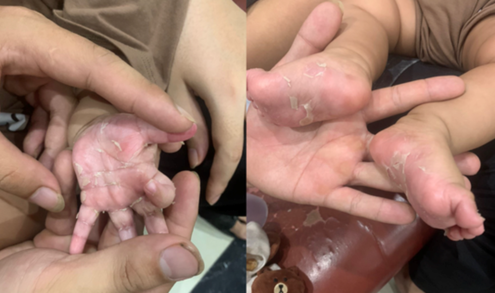 Phòng tránh lây truyền giang mai từ mẹ sang con  - ảnh 1