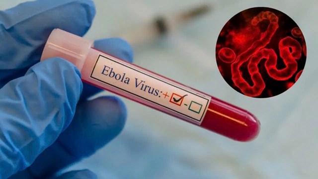 Việt Nam tăng cường các biện pháp giám sát dịch Ebola  - ảnh 1