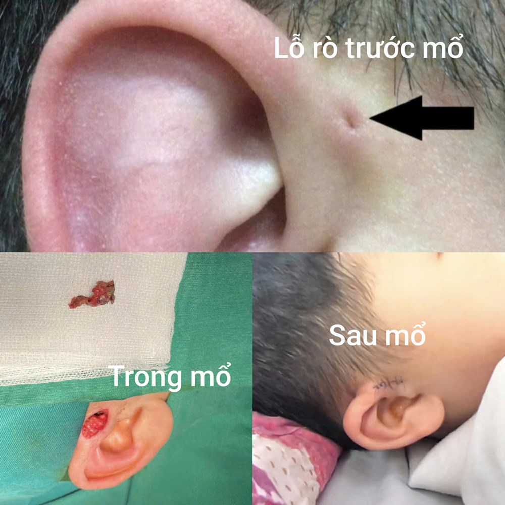 Hy hữu 4 người trong 3 thế hệ cùng mắc một dị tật bẩm sinh - ảnh 2