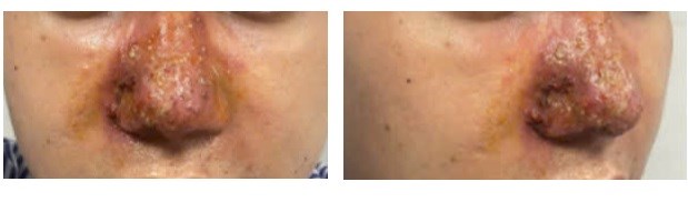 Chọn cơ sở làm đẹp thế nào để tiêm filler an toàn? - ảnh 1