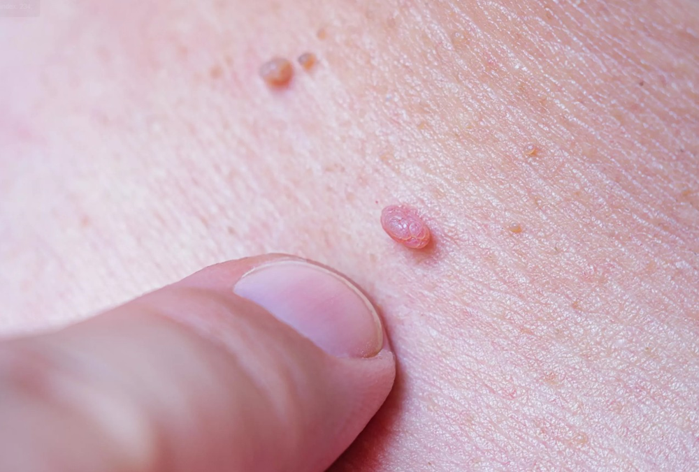 Việc cần làm với con trai để nữ giới giảm HPV - ảnh 1