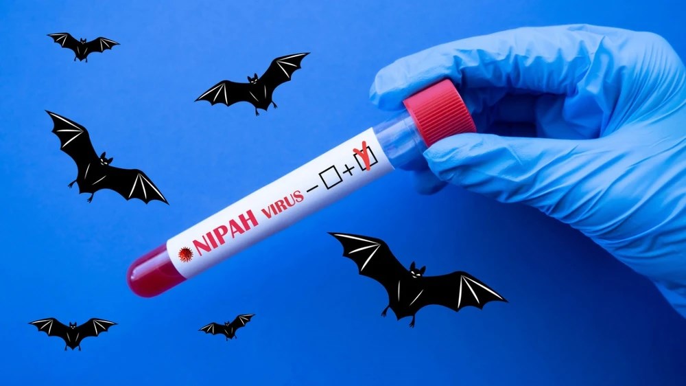 Bác sĩ Bệnh viện Bạch Mai nói thẳng về virus Nipah - ảnh 3