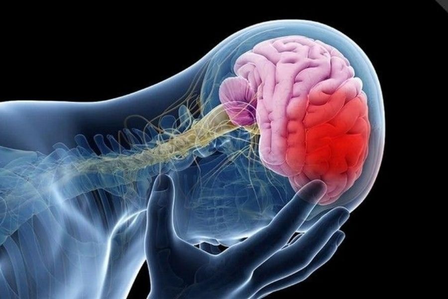 Sau hóa vàng, người đàn ông tê tay tưởng say rượu nên uống chanh mật ong: Sáng hôm sau bác sĩ báo ĐỘT QUỴ - ảnh 3