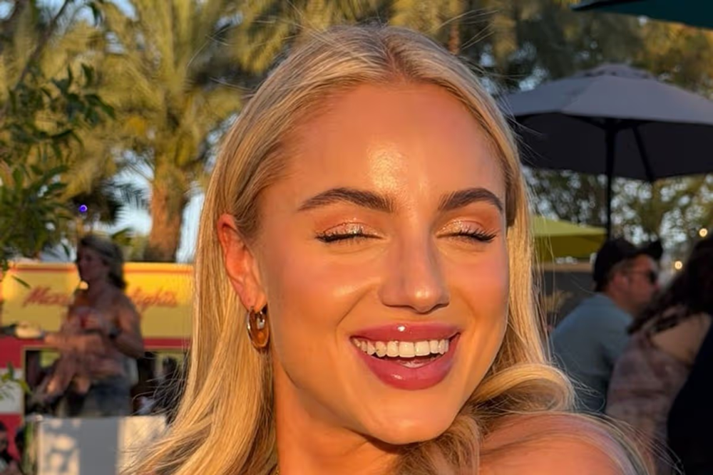 Nữ cầu thủ xinh đẹp nhất thế giới bị chị gái húc gãy mũi - ảnh 1