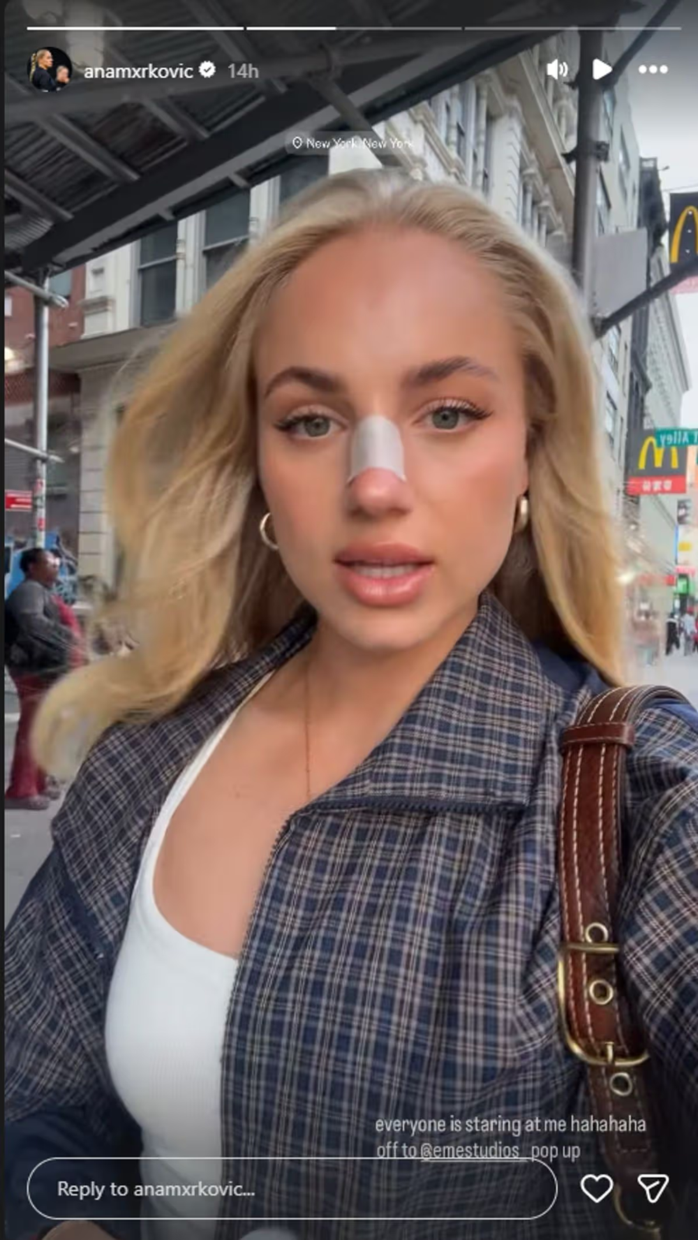 Nữ cầu thủ xinh đẹp nhất thế giới bị chị gái húc gãy mũi - ảnh 2