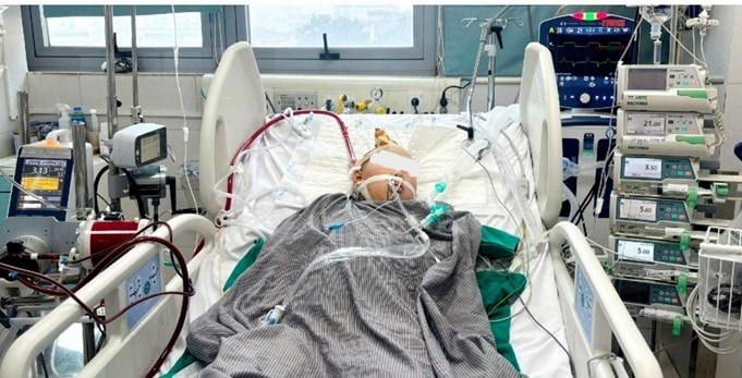 Bệnh nhi 12 tuổi mắc căn bệnh hiếm và nguy hiểm là dị dạng động tĩnh mạch (AVM) tuỷ cổ bẩm sinh.