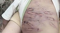 Điều tra vụ bạo hành dã man bé trai 2 tuổi tại TP.HCM