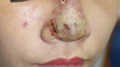 Đi làm đẹp... lại càng xấu