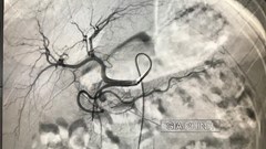 Trẻ hai tuổi có nguy cơ hỏng mắt vì bị chó nhà hàng xóm cắn