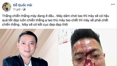 Thực hư chuyện danh hài Chiến Thắng cho vệ sĩ đánh fan hâm mộ chảy máu