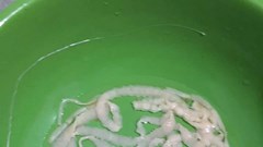 Xổ sán xơ mít dài 8m ký sinh trong cơ thể nam bệnh nhân