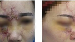 Đi Đài Loan làm đẹp – “tránh vỏ dưa gặp vỏ dừa”